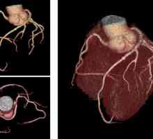 Новият CT скенера за arineta прожектор ct сърце ще отиде в клиниката в САЩ