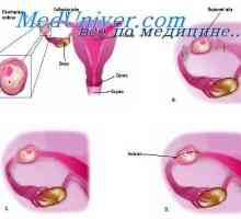 Разглеждане на матката. Изследване на тазовата кухина с извънматочна бременност