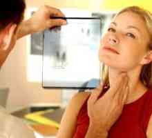 Оценката на пациентите с възли на щитовидната жлеза