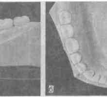 Оценка на състоянието на никненето на зъби