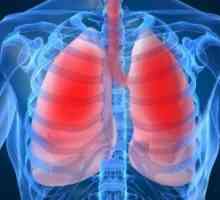 Тумори на дихателните пътища: лечение, симптоми, диагностика