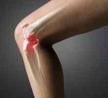 Основните фактори, на костите и мускулите домашните наранявания