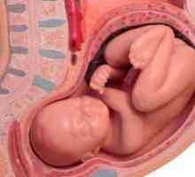 Отлепване на плацентата по време на бременност: симптоми, причини, лечение, симптоми, усложнения