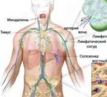 Основно лимфом на централната нервна система