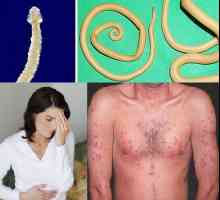 Първите признаци на присъствието на червеи в тялото на възрастен