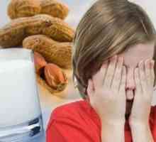 Хранителните алергии при децата на възраст над 7 години