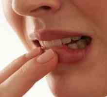 Плоскоклетъчен карцином на устната кухина: лечение, симптоми, прогноза