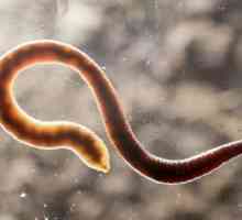 Защо често (постоянно) червеи се появяват при възрастни и деца?