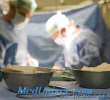Избор на бъбрек трансплантация. оборудване