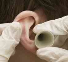 Победете ухото: при получаване на лекарства с херпес зостер