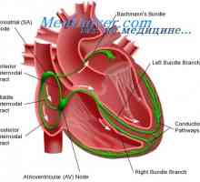 Проводната система на сърцето. синусовия възел