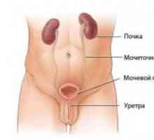 Рак на пикочния мехур и уретрата при жените, при мъжете: симптоми, лечение, етап, знаци