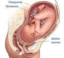 Шийката на матката преди раждане, симптоми, признаци