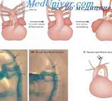 Развитие на артериалната съдова система. Етапи образуване на зародишен аорта