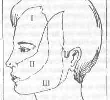 Ролята на тригеминалния нерв, болка на лицето