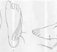 Белег деформация на стъпалото и глезена. Лечение дефекти повърхността на ходилото на крака
