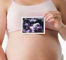 Широки таза на бременни жени