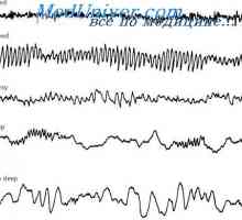 Мозъчните вълни и нива на активност на мозъка. Електроенцефалограм (ЕЕГ) сън