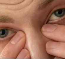 Синдром на сухото око, лечение, симптоми, причини