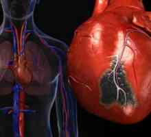 Синдромът на внезапна сърдечна смърт