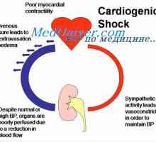 Кардиогенен шок. Физиология на лечение на кардиогенен шок