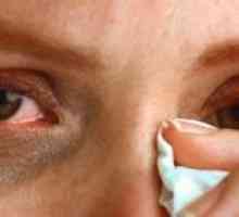 Сълзене на очите: лечение, причини, симптоми, признаци