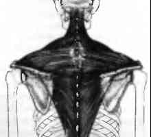 Болки в гърба, причинени от мускулите на трапецовидния мускул