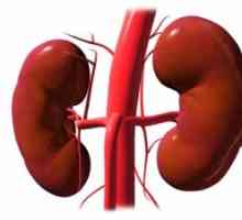 Стеноза и оклузия на бъбречните артерии: симптоми, причини, лечение, симптоми