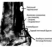 Foot, глезена и долната трета на тибията на радиация и инструменти диагностиката. Патологията на…