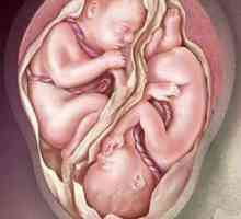 Бременност с близнаци снимка