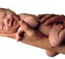 Преждевременно раждане и индикации за цезарово сечение по време на бременност и раждане ..