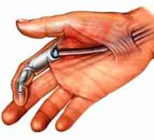 Сухожилията по пръстите на ръцете