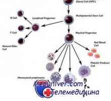 Трансплантация на стволови клетки при заболявания натрупване и таласемия
