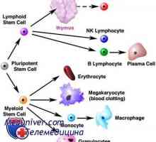 Трансплантация на стволови клетки и неходжкинов лимфом (болест на Ходжкин)
