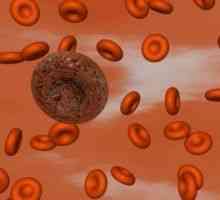 Тромбоцитите нарушения: хемостаза, могат да бъдат идентифицирани?