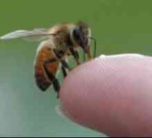 Bites от оси и пчели деца: първа помощ