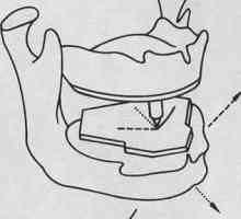 Интраорални регистрация на долната челюст движенията