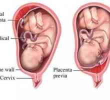 Забавянето в матката и плацентата на съставните му части