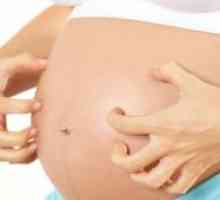 Сърбеж по кожата по време на бременност в ранните и по-късните етапи: причинява, лечение