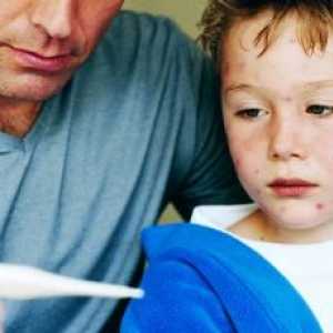 Алергични към отровен бръшлян при деца, симптоми, причини, лечение