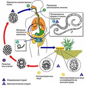 Човешки паразити нематоди (хелминти, червеи), аскариоза заболяване при възрастни