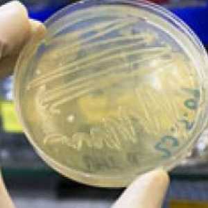 Биохимичен анализ на фекални бактерии свръхрастеж