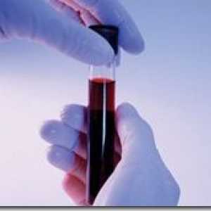 Биохимичен анализ на кръв