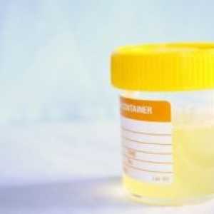 Биохимичен анализ на урината