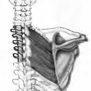 Болки в гърба, причинени от ромбоидни мускули
