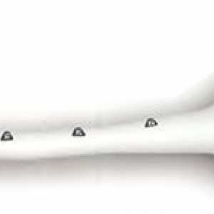 Корема-анален резекция на ректума с колостомия в коремната стена