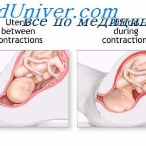 Коремните мускули време на раждането. активност на матката