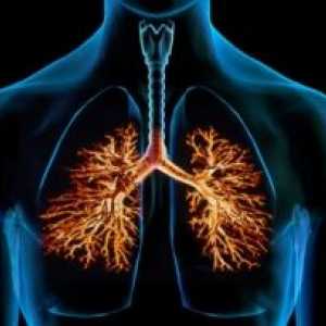 Бронхиектазиите в белите дробове: лечение, симптоми, диагностика, причините, симптомите