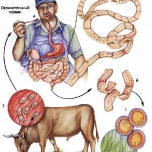Говеда (невъоръжен) тения инфекция говеждо тения при хората