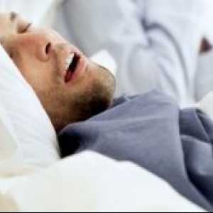 Централната сънна апнея: лечение, симптоми, причини, диагноза